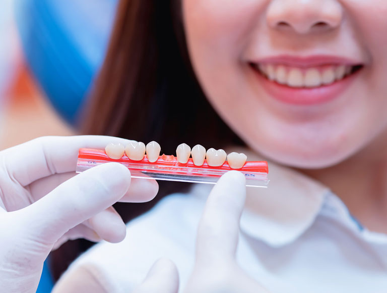 What is a Tooth Crown?