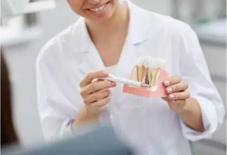 Dental Implants