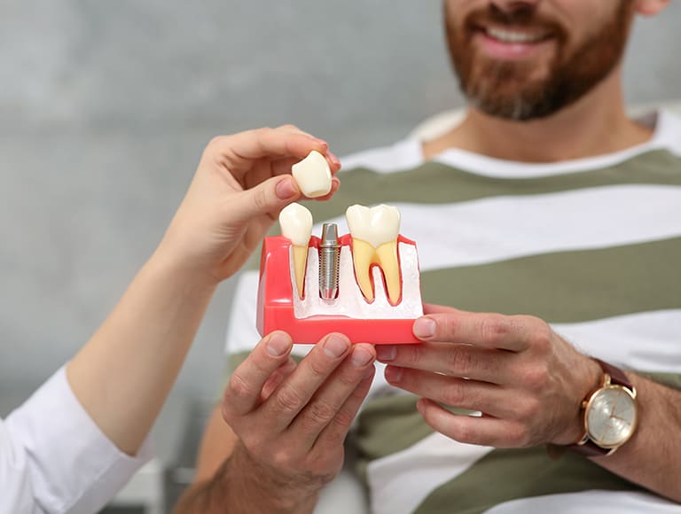 What are Dental Implants?