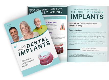 Implant Guidelines