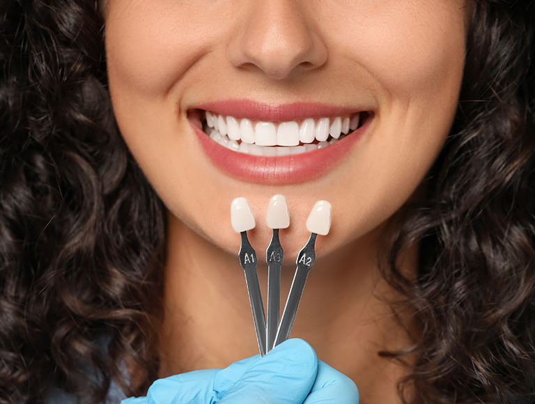 What are Porcelain Veneers?